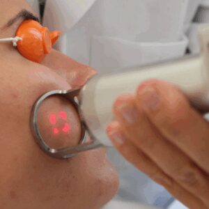 sesion-de-eliminacion-de-cicatrices