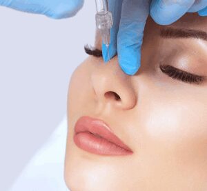 sesion-tratamiento-remodelacion-facial