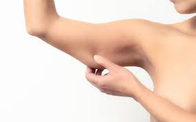 sesion-tratamiento-reduccion-flacidez-de-brazos