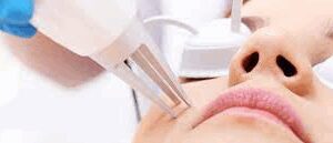sesion-tratamiento-de-lesiones-piel--nevus--fibromas--queratosis