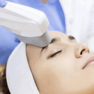 sesion-laser-ipl-completo-mujer