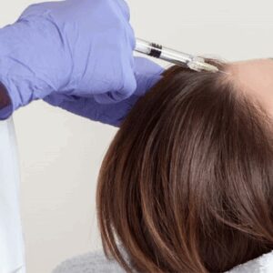 sesion-mesoterapia-capilar