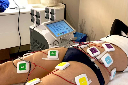 sesion-electroestimulacion