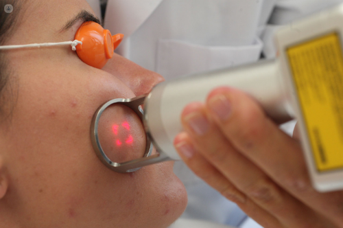 sesion-de-eliminacion-de-cicatrices