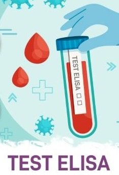 prueba-serologica-elisa-covid-con-extraccion