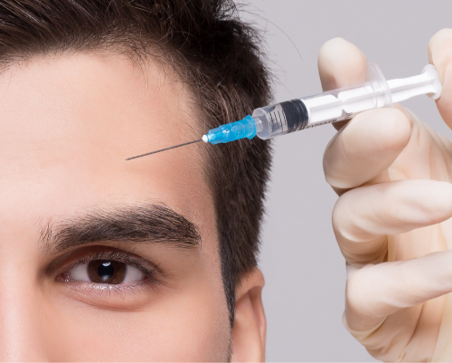 sesion-mesoterapia-facial-con-acido-hialuronico