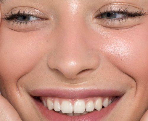 sesion-peeling-seborregulador