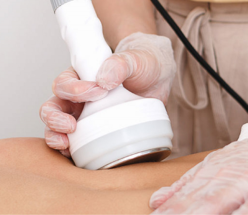 sesion-radiofrecuencia-corporal