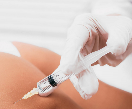 sesion-tratamiento-mesoterapia-cuello-y-escote