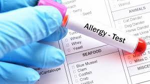 test-estudio-de-20-ige--alergias-alimentarias