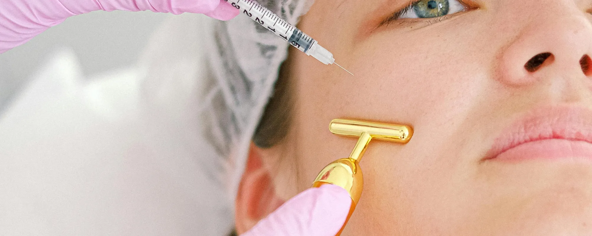 Carboxiterapia de Bolsas-Ojeras