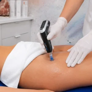sesion-dermapen-corporal