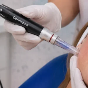 sesion-dermapen-facial
