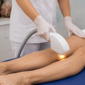 sesion-ipl-de-piernas-enteras