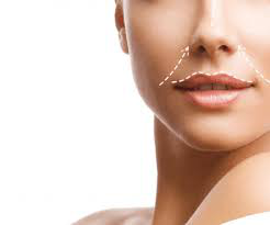 sesion-tratamiento-eliminacion-surco-nasogeniano