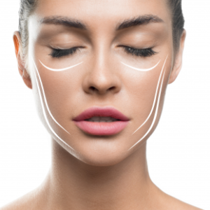 sesion-tratamiento-bioplastia-lifting-liquido