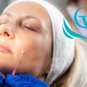 sesion-tratamiento-hilos-tensores