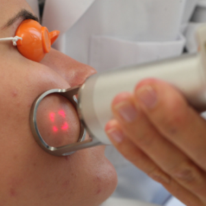 sesion-tratamiento-antimanchas