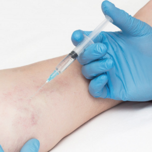 sesion-tratamiento-esclerosis-de-varices