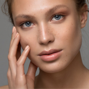 sesion-peeling-acido-acelaico