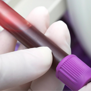 test-a200-sangre-intolerancia-alimentaria-sangre