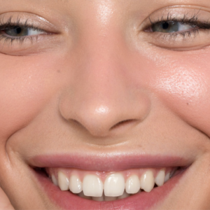 sesion-peeling-seborregulador