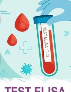 prueba-serologica-elisa-covid-con-extraccion