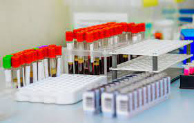 test-acidos-grasos-en-suero-ag36