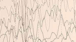 test-fg-neuro-epilepsia