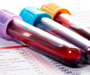 ANALÍTICA SCEL GLUTEN HLA DQ2 DQ8