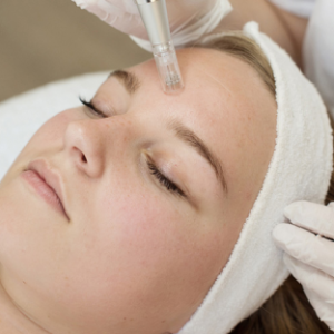 sesion-oxigenacion-facial