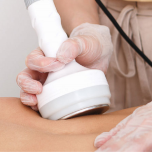 sesion-radiofrecuencia-corporal