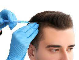 sesion-tratamiento-bioestimulacion-prp-plasma