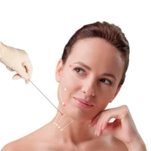 endolift-facial-y-cuello