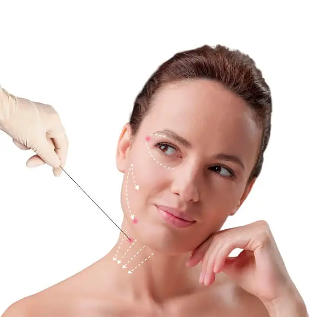 ENDOLIFT facial y Cuello