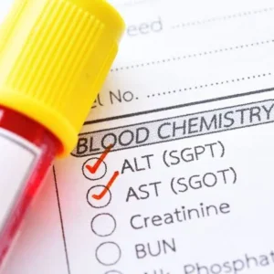 got-sgot-asat-suero