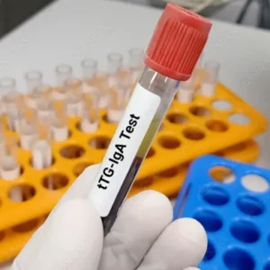 transglutaminasa-tisular-iga-anticuerpos-suero