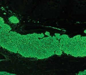 (AENDM) ENDOMISIO ANTICUERPOS IGA, SUERO
