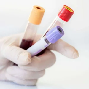 (AGLIDA) GLIADINA DEAMINADA ANTICUERPOS IGA, SUERO