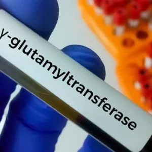ggt-gamma-glutamil-transpeptidasa