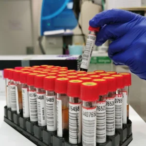 iono-ionograma-na-k-cl-suero