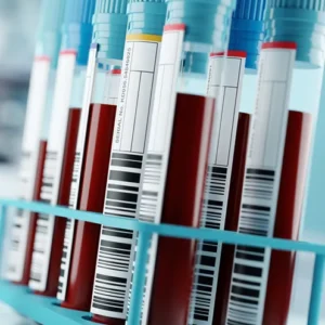 ha1c-hemoglobina-glicosilada-a1c-sangre-total