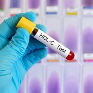 ch-colesterol-hdl-suero