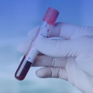 (CT) COLESTEROL, TOTAL, SUERO