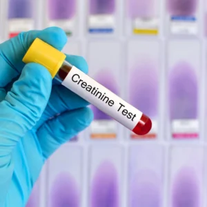 cti-creatinina-suero