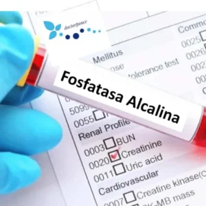 fal-fosfatasa-alcalina-total-suero