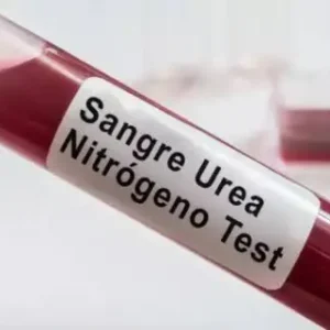 BUN (NITRÓGENO URÉICO), SUERO